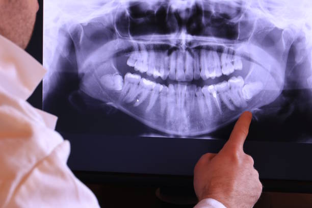 Best Emergency Dental Care for Sports Injuries in Attica, IN
